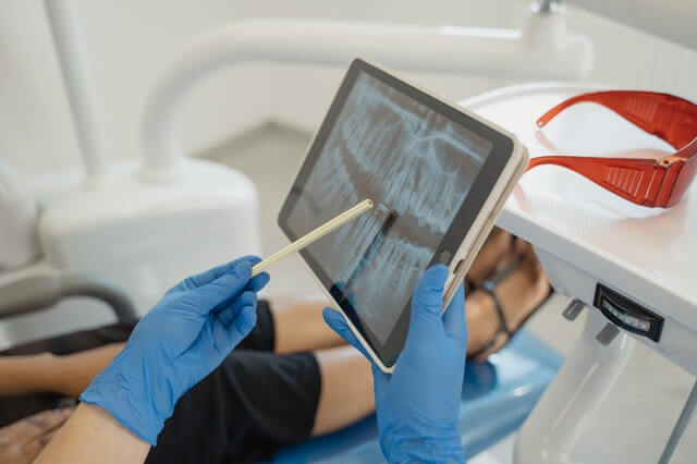 Digitale Zahnmedizin - Röntgenbild eines Gebisses